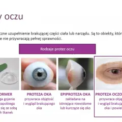 Różne rodzaje protez oczu: konformer, proteza oka, epiproteza oka, proteza oczodołu.