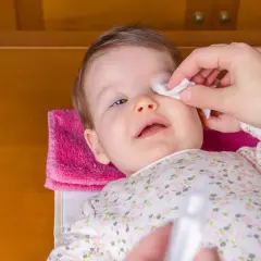 Delikatne przemywanie oka niemowlaka wacikiem nasączonym solą fizjologiczną.