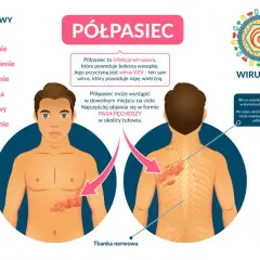 Ilustracja przedstawia objawy półpaśca: wysypkę na tułowiu i plecach, wirusa VZV oraz listę objawów.