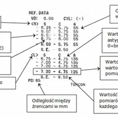 Jak czytać wyniki badania wzroku u okulisty i uniknąć błędów