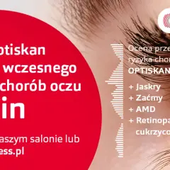 Czy badanie wzroku w Vision Express jest wiarygodne? Opinie i fakty