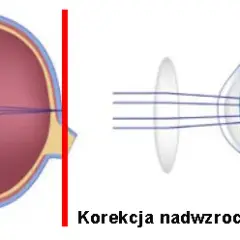 Wada wzroku jak widzi: jak różne wady wpływają na percepcję świata