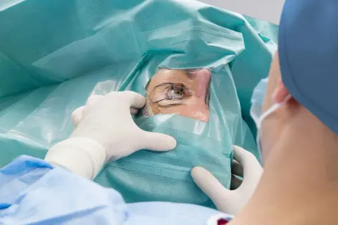 Oko pacjenta przygotowywane do zabiegu korekty laserowej wzroku. Chirurg w rękawiczkach precyzyjnie odsłania oko.