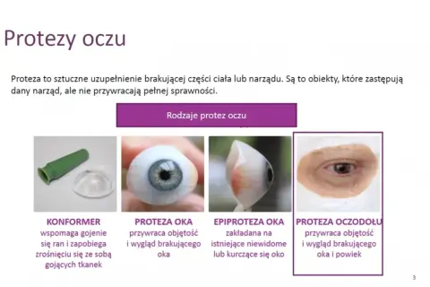 Różne rodzaje protez oczu: konformer, proteza oka, epiproteza oka, proteza oczodołu.