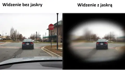 Widzenie bez jaskry jest ostre, z jaskrą widzenie w nocy jest rozmazane, jakby przez mgłę.