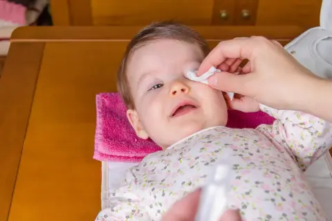 Delikatne przemywanie oka niemowlaka wacikiem nasączonym solą fizjologiczną.