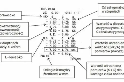 Jak czytać wyniki badania wzroku u okulisty i uniknąć błędów