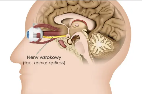 Przekrój głowy z widocznym okiem i nerwem wzrokowym połączonym z mózgiem.
