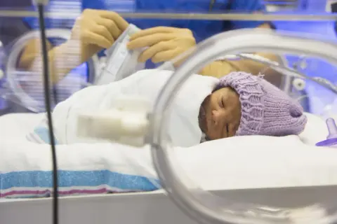 Noworodek w inkubatorze, ubrany w fioletową czapeczkę, otulony białym kocykiem.
