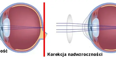 Wada wzroku jak widzi: jak różne wady wpływają na percepcję świata