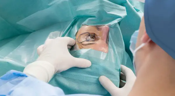 Oko pacjenta przygotowywane do zabiegu korekty laserowej wzroku. Chirurg w rękawiczkach precyzyjnie odsłania oko.