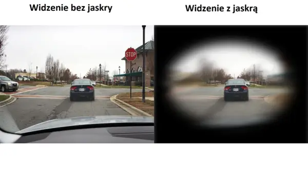 Porównanie widzenia: po lewej - normalne, po prawej - z jaskrą (widoczne ubytki w polu widzenia).