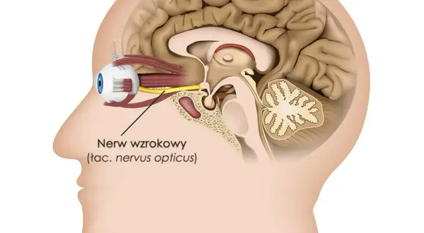Przekrój głowy ukazujący oko i mózg. Żółty nerw wzrokowy łączy oko z mózgiem, umożliwiając widzenie.