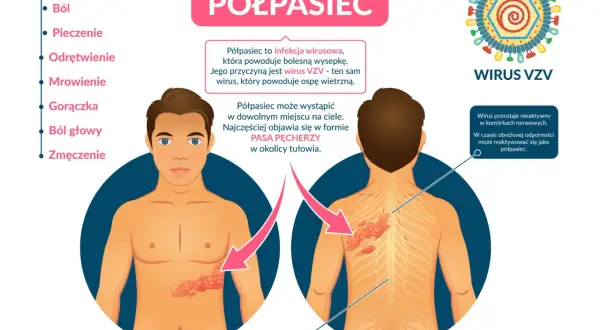 Ilustracja przedstawia objawy półpaśca: wysypkę na tułowiu i plecach, wirusa VZV oraz listę objawów.