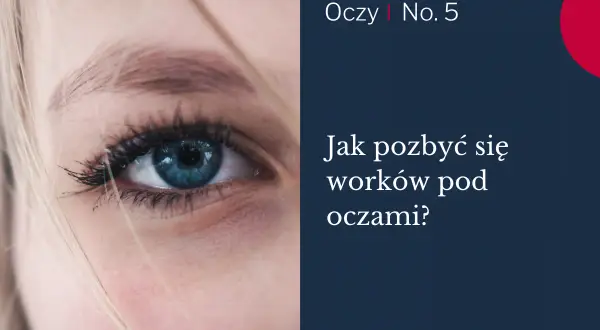 Zbliżenie na niebieskie oko z widocznymi cieniami pod oczami.