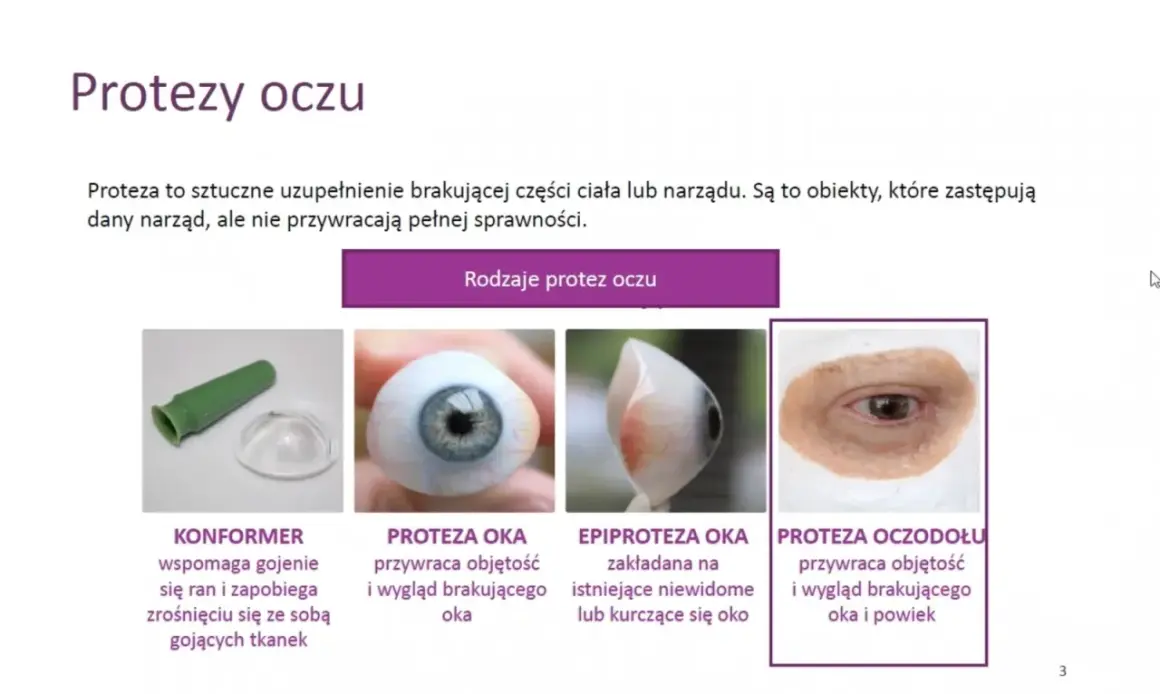 Różne rodzaje protez oczu: konformer, proteza oka, epiproteza oka, proteza oczodołu.