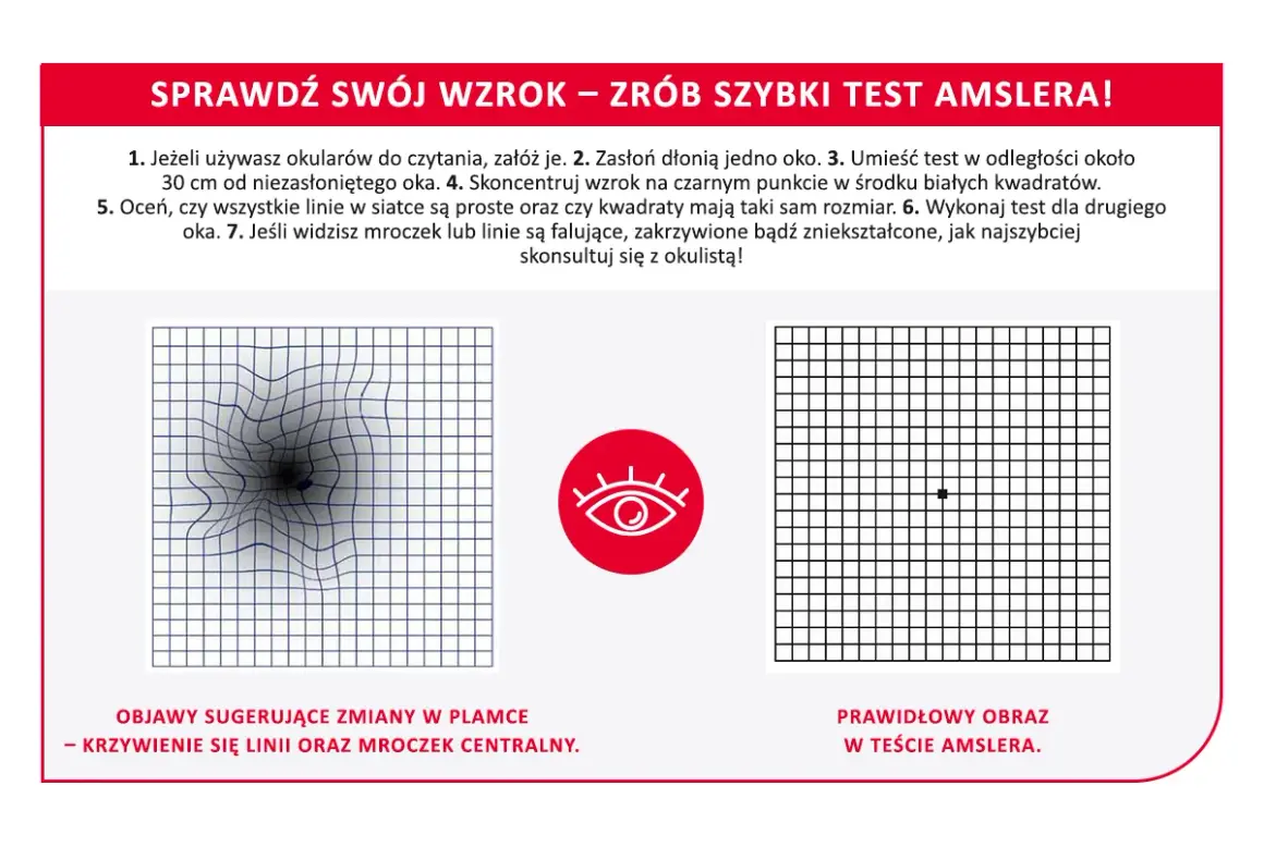 Test Amslera pokazuje zniekształcone linie, sugerując zmiany w plamce żółtej. Domowe sposoby na zwyrodnienie plamki żółtej mogą obejmować regularne badania wzroku.
