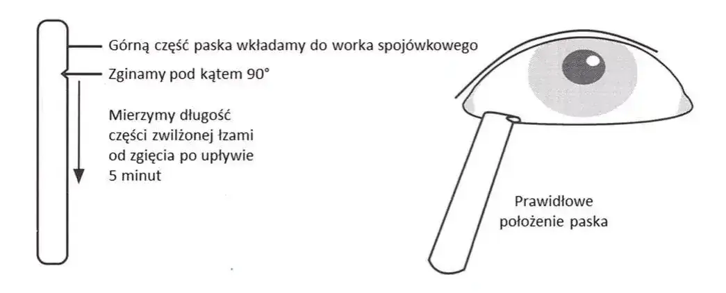 Zdjęcie Jakie badania na jaskrę? Kluczowe testy dla zdrowia oczu