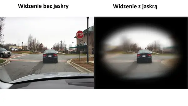 Widzenie bez jaskry jest ostre, z jaskrą widzenie w nocy jest rozmazane, jakby przez mgłę.