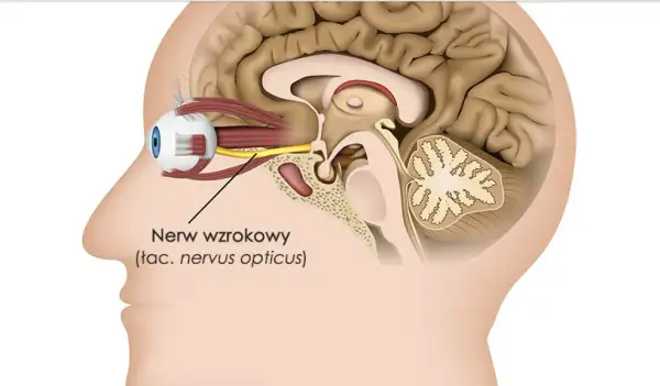 Przekrój głowy ukazujący oko i mózg. Żółty nerw wzrokowy łączy oko z mózgiem, umożliwiając widzenie.