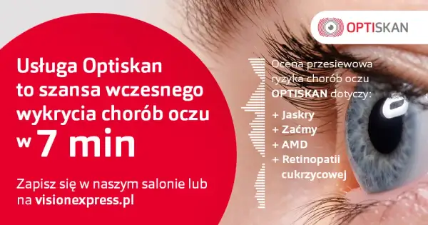 Czy badanie wzroku w Vision Express jest wiarygodne? Opinie i fakty