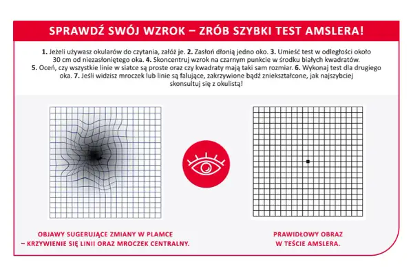Test Amslera pokazuje zniekształcone linie, sugerując zmiany w plamce żółtej. Domowe sposoby na zwyrodnienie plamki żółtej mogą obejmować regularne badania wzroku.